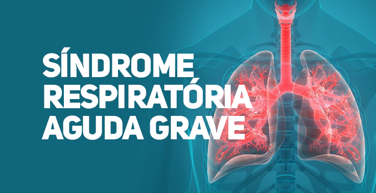 Imagem com fundo azul-esverdeado contendo o texto SÍNDROME RESPIRATÓRIA AGUDA GRAVE em letras maiúsculas e na cor branca, posicionado no lado esquerdo em três linhas. No lado direito, há uma ilustração anatômica tridimensional do sistema respiratório humano, destacando a traqueia, os brônquios e os pulmões em tom vermelho brilhante dentro da silhueta translúcida de um tórax.