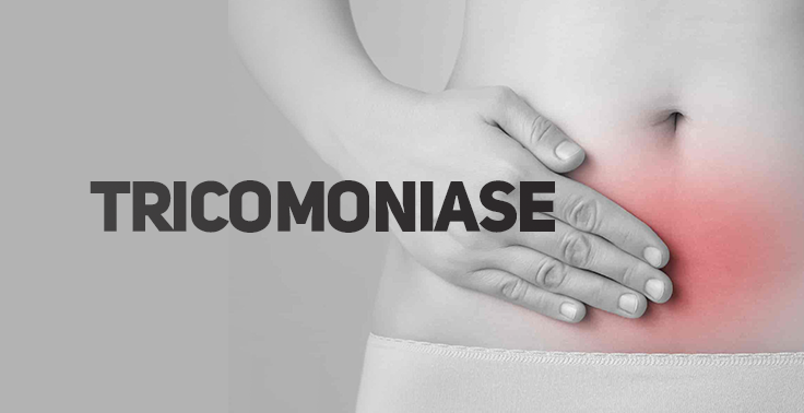 Imagem de campanha com fundo escuro contendo o texto TRICOMONÍASE em letras maiúsculas no lado esquerdo, alertando para a prevenção de Infecções Sexualmente Transmissíveis.