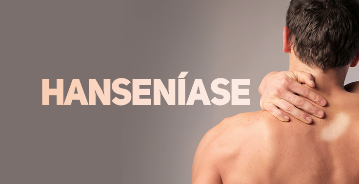 Imagem informativa de saúde com o texto HANSENÍASE em letras maiúsculas bege sobre fundo cinza. No canto direito, vê-se a parte superior das costas e o pescoço de um homem sem camisa, que segura a nuca com a mão. Há uma mancha esbranquiçada visível na pele do ombro.