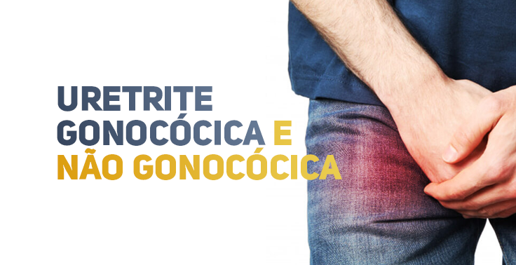 Imagem com fundo claro contendo o texto URETRITE GONOCÓCICA E NÃO GONOCÓCICA em letras maiúsculas no lado esquerdo, distribuído em três linhas. As palavras URETRITE e GONOCÓCICA estão em tom azul-escuro/cinza, enquanto a conjunção E e as palavras NÃO GONOCÓCICA estão na cor amarela/dourada. No lado direito, um homem vestindo camiseta azul e calça jeans é visto da cintura para baixo, segurando a região pélvica/virilha com as mãos. A área da virilha apresenta um destaque avermelhado translúcido sobre o jeans, sinalizando dor ou inflamação no local.