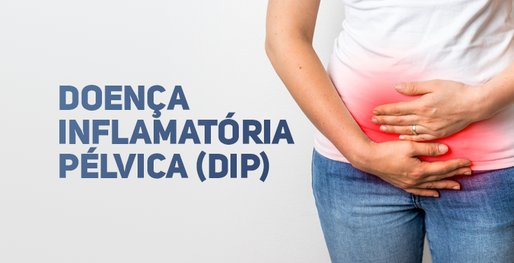 Imagem de uma mulher segurando a região inferior do abdômen, destacada em vermelho para indicar dor pélvica, ao lado do texto 'Doença Inflamatória Pélvica (DIP)'.