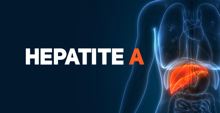 Imagem informativa de saúde com fundo azul-escuro. No lado esquerdo, sobressai o texto HEPATITE em letras brancas e a letra A em laranja. No lado direito, há uma ilustração anatômica estilizada do tronco humano transparente, com o fígado destacado em cor laranja brilhante.