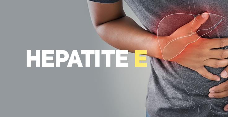 Imagem informativa de saúde com fundo cinza. No lado esquerdo, sobressai o texto HEPATITE em letras brancas e a letra E em amarelo-claro. No lado direito, uma pessoa de pele negra veste camiseta cinza e pressiona o lado direito do abdômen com as mãos, sob o contorno estilizado e avermelhado de um fígado.