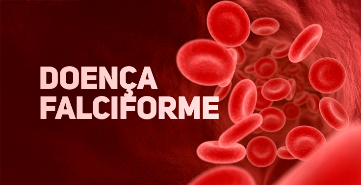 Banner com o título 'DOENÇA FALCIFORME' em destaque sobre ilustração do interior de um vaso sanguíneo com glóbulos vermelhos em diferentes planos.