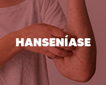 Hanseníase