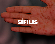 Sífilis