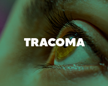 Tracoma